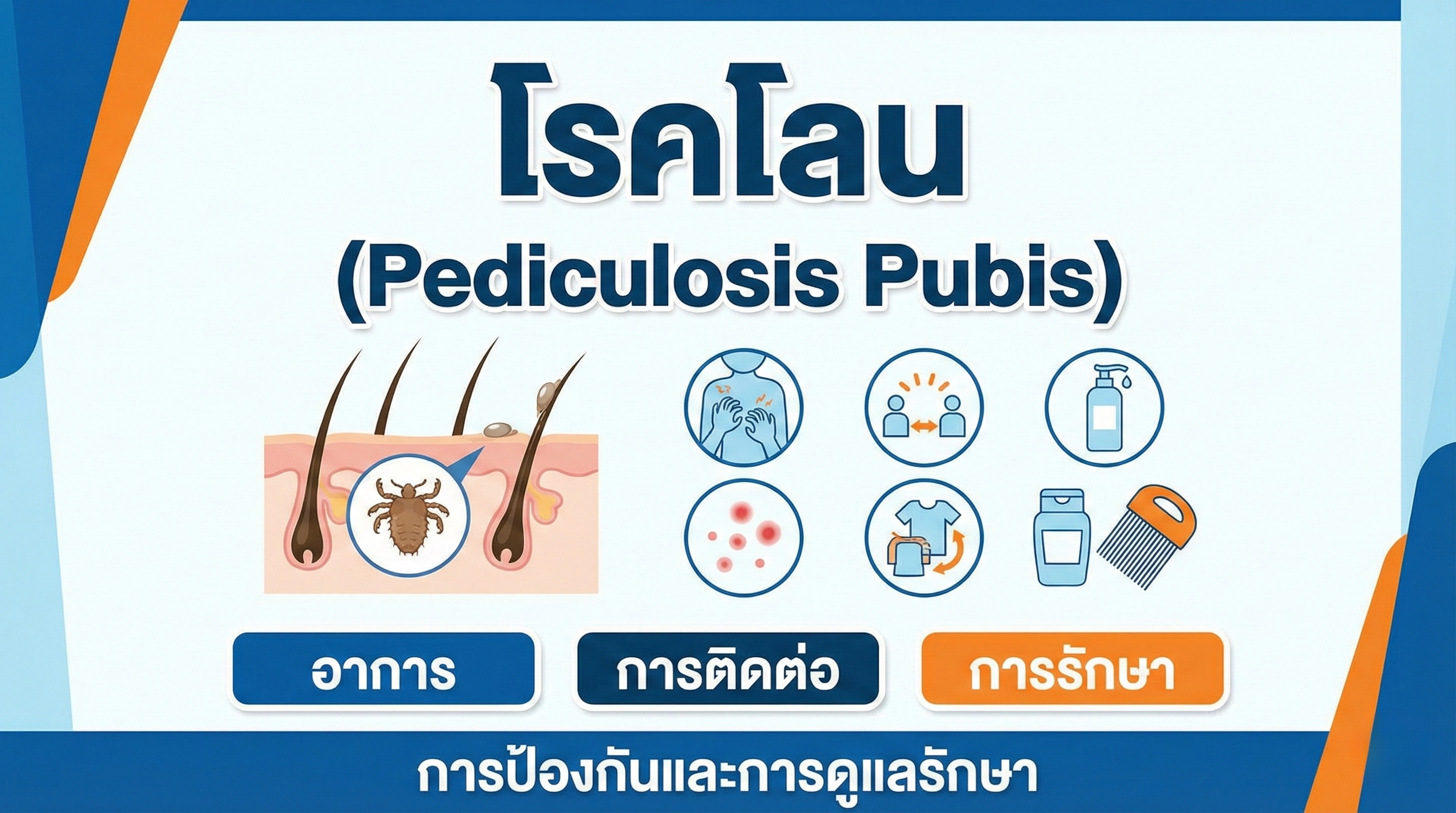 โรคโลน (Pediculosis Pubis)